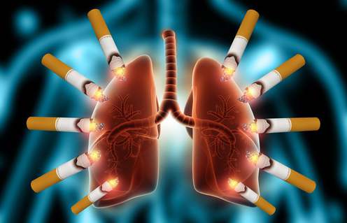 التهاب الشعب الهوائية المصاحب للتدخين