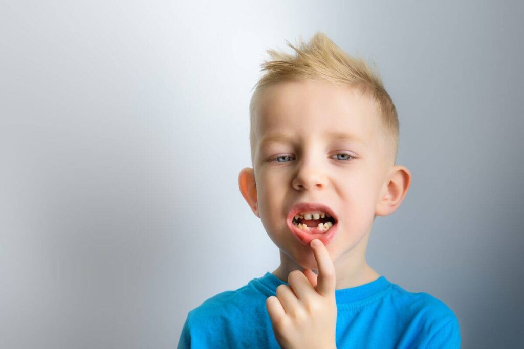 علاج الفراغات بين الأسنان بالاعشاب