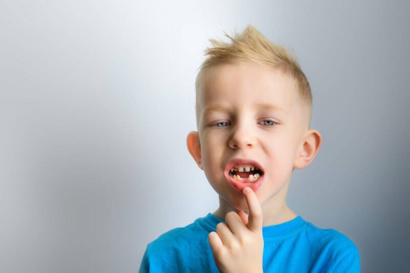 امراض اللثة و الاسنان