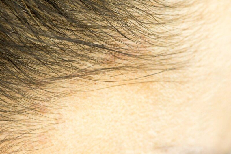 علاج الشعر المحروق من كريم الفرد
