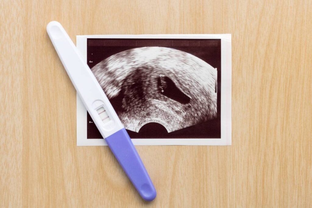 نزيف اللثة للحامل ونوع الجنين