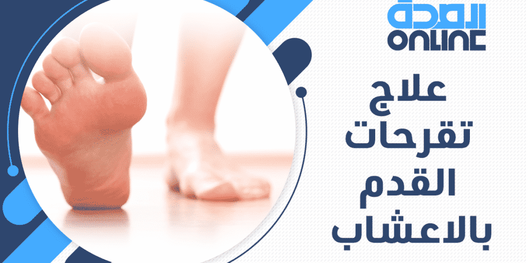 تعرف على أشهر 10 نباتات مستخدمة في علاج تقرحات القدم بالاعشاب الصحة أونلاين