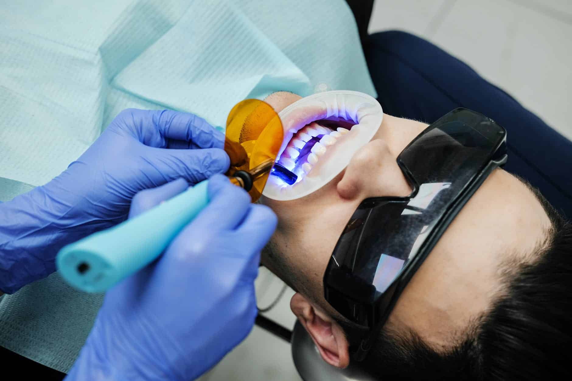 تسوس الاسنان الامامية وعلاجها