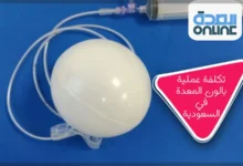 تكلفة عملية بالون المعدة في السعودية