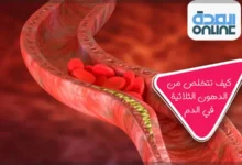 كيف تتخلص من الدهون الثلاثية في الدم